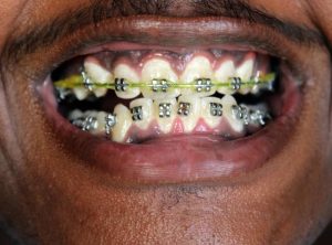 Transform your Smile